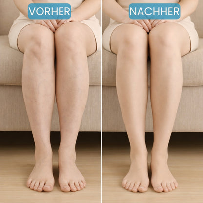 VenoFit - Kompressionsstrümpfe